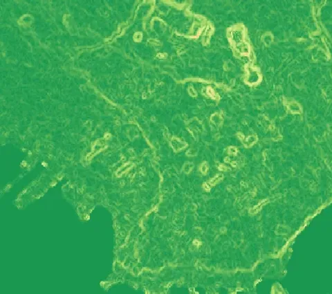 Pendenza del Terreno